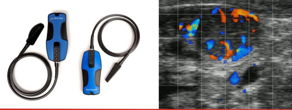 Two ultrasound scanners and an ultrasound image